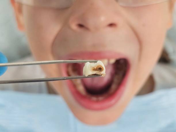 Best Holiday Emergency Dentist in Contra Costa Centre, CA