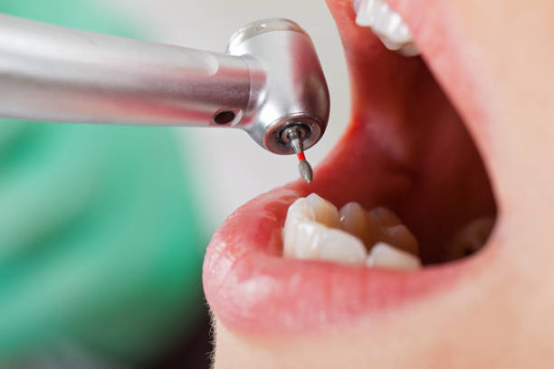 Best Holiday Emergency Dentist in Contra Costa Centre, CA